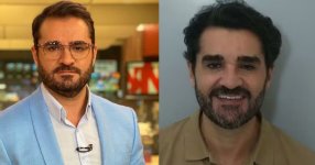 Marcelo Cosme mostra o antes e depois do transplante capilar